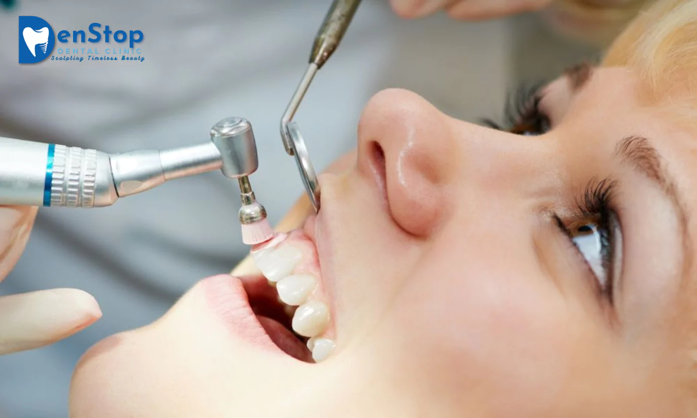 Routine Dental Treatments Gateway To Keeping Your Smile Healthy and Functional